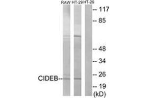 Western blot analysis of extracts from HT-29/RAW264. (CIDEB 抗体  (AA 91-140))