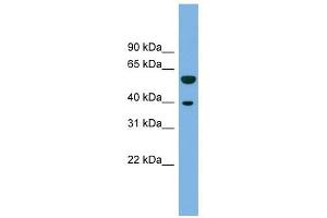 C19ORF28 antibody used at 1 ug/ml to detect target protein. (C19orf28 抗体  (N-Term))