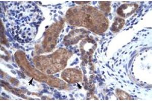Immunohistochemical staining (Formalin-fixed paraffin-embedded sections) of human kidney with IKZF2 polyclonal antibody  at 4-8 ug/mL working concentration. (IKZF2 抗体  (C-Term))