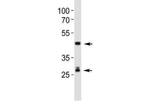 Western Blotting (WB) image for anti-Sonic Hedgehog (SHH) (AA 395-450) antibody (ABIN3029025)