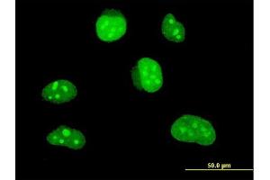 Immunofluorescence of monoclonal antibody to HLF on HeLa cell. (HLF 抗体  (AA 1-295))