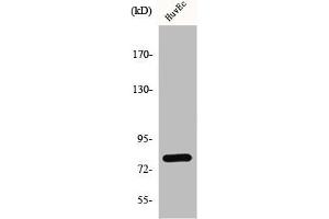 Western Blot analysis of HuvEc cells using GRK 2 Polyclonal Antibody (GRK2 抗体  (C-Term))