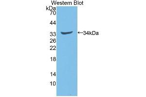 Detection of Recombinant NQO1, Rat using Polyclonal Antibody to NADH Dehydrogenase, Quinone 1 (NQO1) (NQO1 抗体  (AA 2-273))