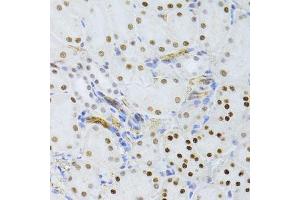 Immunohistochemistry of paraffin-embedded mouse kidney using SNRNP70 antibody. (SNRNP70 抗体  (AA 150-250))