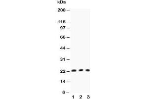 Western blot testing of TNFb antibody and Lane 1:  HeLa;  2: MCF-7;  3: COLO320 (LTA 抗体  (AA 45-59))