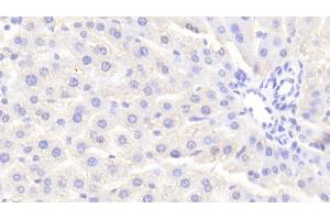 Detection of NR0B2 in Rat Liver Tissue using Polyclonal Antibody to Nuclear Receptor Subfamily 0,Group B,Member 2 (NR0B2)