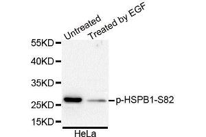 Western Blotting (WB) image for anti-Heat Shock 27kDa Protein 1 (HSPB1) (pSer82) antibody (ABIN3023550) (HSP27 抗体  (pSer82))