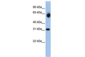 Image no. 1 for anti-Dehydrogenase/reductase (SDR Family) Member 2 (DHRS2) (AA 108-157) antibody (ABIN6740754) (DHRS2 抗体  (AA 108-157))