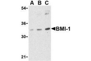 Western blot analysis of BMI-1 in K562 cell lysate with AP30158PU-N BMI-1 antibody at (A) 0. (BMI1 抗体  (Intermediate Domain))