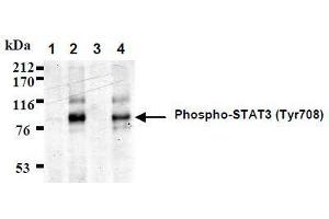 Western Blotting (WB) image for anti-Signal Transducer and Activator of Transcription 3 (Acute-Phase Response Factor) (STAT3) (AA 703-714), (pTyr705), (pTyr708) antibody (ABIN1449165) (STAT3 抗体  (pTyr705, pTyr708))