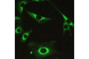 Immunohistochemistry (IHC) image for anti-Myosin Phosphatase, Target Subunit 1 (PPP1R12A) (AA 1-40), (N-Term) antibody (ABIN3043902)