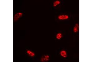 Immunofluorescent analysis of Histone H2B (AcK15) staining in Hela cells. (Histone H2B 抗体  (acLys15, N-Term))
