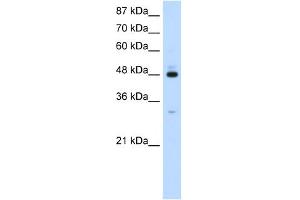 WB Suggested Anti-PAIP1 Antibody Titration:  1. (PAIP1 抗体  (C-Term))