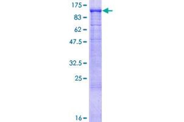 GAA Protein (AA 1-952) (GST tag)