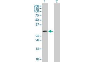 Western Blotting (WB) image for anti-serine Peptidase Inhibitor, Kunitz Type, 2 (SPINT2) (AA 1-252) antibody (ABIN524087)