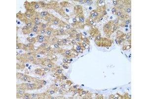 Immunohistochemistry of paraffin-embedded Human liver using CCM2 Polyclonal Antibody at dilution of 1:100 (40x lens). (CCM2 抗体)