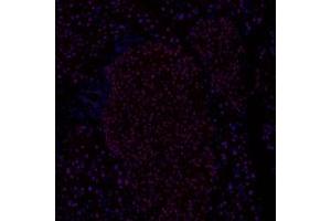 Immunofluorescence (fixed cells) (IF/ICC) image for anti-Ring Finger Protein 1 (RING1) antibody (ABIN7075467)