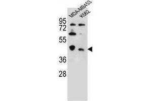 CTBP1 Antibody (C-term) western blot analysis in MDA-MB453,K562 cell line lysates (35µg/lane). (CTBP1 抗体  (C-Term))