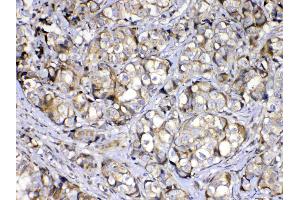 IHC analysis of COPE using anti-COPE antibody . (COPE 抗体  (AA 80-308))