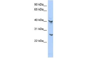 anti-ATPase, H+ Transporting V0 Subunit E2 (ATP6V0E2) (Middle Region) antibody