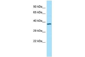 WB Suggested Anti-TMOD4 Antibody Titration: 1. (Tropomodulin 4 抗体  (Middle Region))