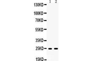 Western blot analysis of Apolipoprotein A I expression in rat liver extract (lane 1) and rat testis extract (lane 2). (APOA1 抗体  (AA 25-259))