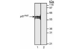 Western blot analysis of p57[Kip2]. (CDKN1C 抗体)