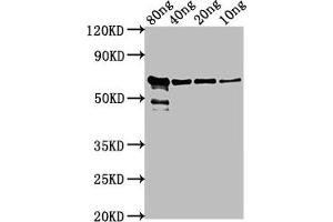 Western Blot Positive WB detected in Recombinant protein All lanes: VP2 antibody at 1:2000 Secondary Goat polyclonal to rabbit IgG at 1/50000 dilution Predicted band size: 62 kDa Observed band size: 62 kDa (VP2 (AA 1-216) 抗体)