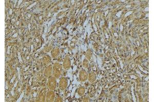 ABIN6273009 at 1/100 staining Mouse kidney tissue by IHC-P. (MYH4 抗体  (Internal Region))