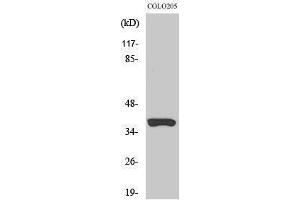 Western Blotting (WB) image for anti-Olfactory Receptor, Family 52, Subfamily B, Member 2 (OR52B2) (Internal Region) antibody (ABIN3186128) (OR52B2 抗体  (Internal Region))