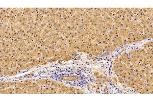 Immunohistochemistry (IHC) image for anti-Interleukin 10 Receptor, beta (IL10RB) (AA 87-243) antibody (ABIN7437275)