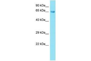 Host: Rabbit Target Name: CNMPD1 Sample Type: Fetal Lung lysates Antibody Dilution: 1. (CNBD2 抗体  (C-Term))