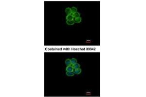 ICC/IF Image Immunofluorescence analysis of methanol-fixed A431, using SGLT1, antibody at 1:500 dilution. (SLC5A1 抗体  (Center))