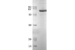 Western Blotting (WB) image for Arylsulfatase A (ARSA) (Transcript Variant 1) protein (His tag) (ABIN2714957)