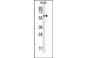 Image no. 1 for anti-Src-Related Kinase Lacking C-Terminal Regulatory Tyrosine and N-Terminal Myristylation Sites (SRMS) (N-Term) antibody (ABIN359993)