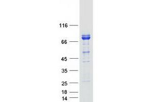 Validation with Western Blot