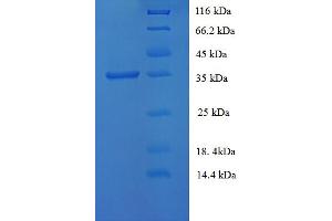 SDS-PAGE (SDS) image for Tissue Factor Pathway Inhibitor (Lipoprotein-Associated Coagulation Inhibitor) (TFPI) (AA 25-300) protein (His tag) (ABIN5710478)