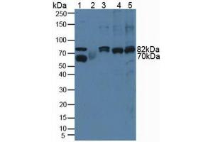 Western Blotting (WB) image for anti-Calpain 1, Large Subunit (CAPNL1) (AA 387-694) antibody (ABIN2901959)