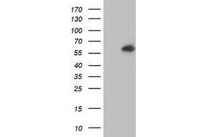Western Blotting (WB) image for anti-V-Akt Murine Thymoma Viral Oncogene Homolog 1 (AKT1) antibody (ABIN1496557) (AKT1 抗体)
