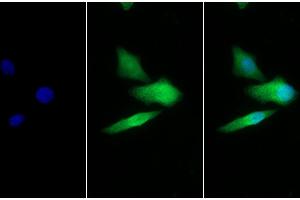 Detection of GLa in Human Hela cell using Polyclonal Antibody to Galactosidase Alpha (GLa) (GLA 抗体  (AA 147-371))