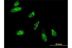 Immunofluorescence (IF) image for anti-Heart and Neural Crest Derivatives Expressed 2 (HAND2) (AA 135-216) antibody (ABIN522934)