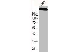 Western Blotting (WB) image for anti-Sodium Channel, Voltage-Gated, Type IX, alpha Subunit (SCN9A) (Internal Region) antibody (ABIN7187421)