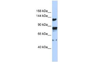 TRPM4 antibody used at 1 ug/ml to detect target protein. (TRPM4 抗体  (N-Term))