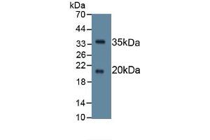 Western Blotting (WB) image for anti-serine Peptidase Inhibitor, Kazal Type 5 (SPINK5) (AA 699-976) antibody (ABIN7427198)