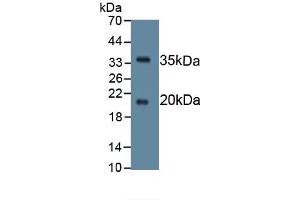 Detection of Recombinant SPINK5, Human using Monoclonal Antibody to Serine Peptidase Inhibitor Kazal Type 5 (SPINK5) (SPINK5 抗体  (AA 699-976))