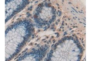 Detection of CHI3L1 in Human Rectum Tissue using Polyclonal Antibody to Chitinase-3-like Protein 1 (CHI3L1)