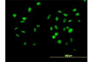 Immunofluorescence of purified MaxPab antibody to CUL4B on HeLa cell.