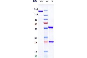 Anti-IL-6Ra / CD126 Reference Antibody (APX007) on SDS-PAGE under reducing (R) condition.