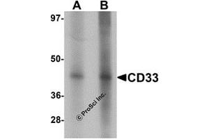 Western Blotting (WB) image for anti-CD33 (CD33) (Middle Region) antibody (ABIN1030903) (CD33 抗体  (Middle Region))