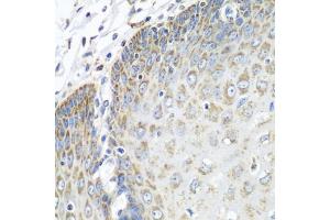 Immunohistochemistry of paraffin-embedded human esophagus using TMOD3 antibody (ABIN1683055, ABIN3019135, ABIN3019136 and ABIN6220733) at dilution of 1:100 (40x lens). (TMOD3 抗体  (AA 1-352))